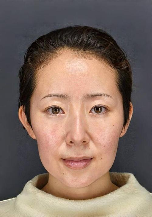 怎么去除视频遮挡脸部的图片去掉