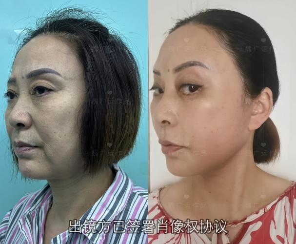 苹果面容坏了的维修服务