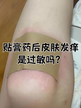 膏药粘上用什么清除掉