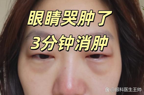 眼睛哭了会肿吗缩略图