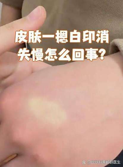 ipad屏幕按压变色