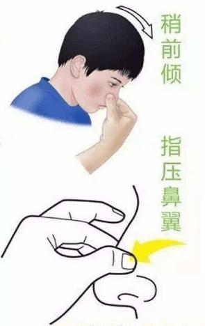流鼻血是什么原因造成的