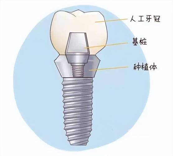 错误678解决步骤图解