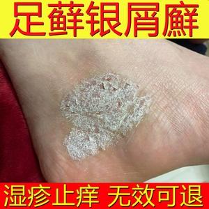 专治脚裂的药膏图标