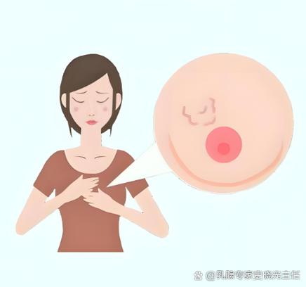 乳腺结节是什么病游戏截图