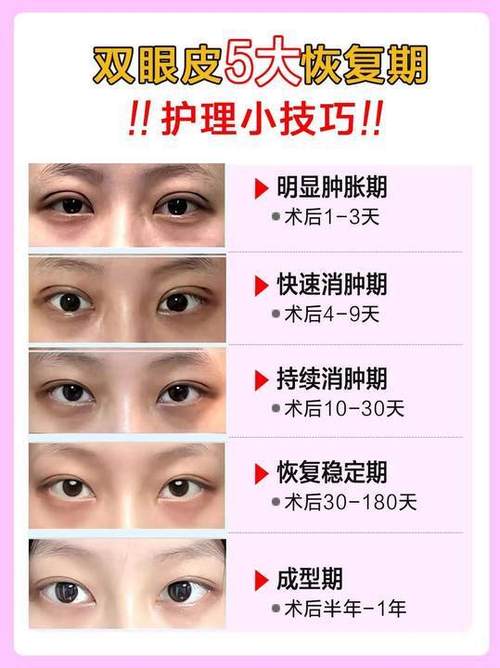 女人眼睛哭肿了怎么快速消肿缩略图