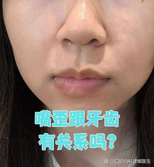 掉了牙齿对嘴歪有关系吗游戏截图