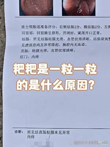 拉屎拉的一粒一粒的怎么回事缩略图