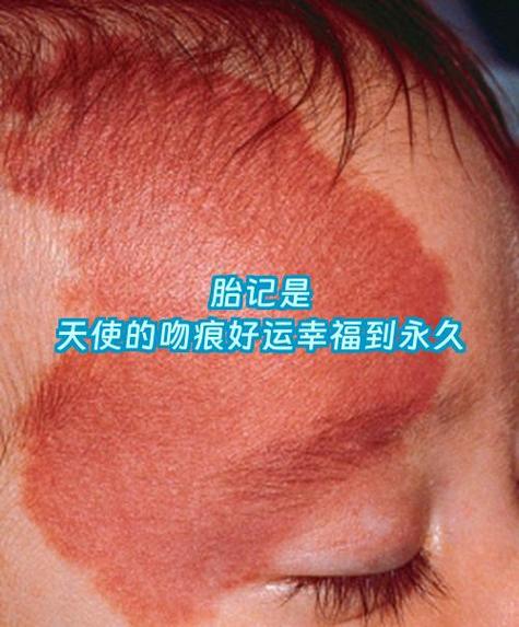 张杰 谢娜二胎图标