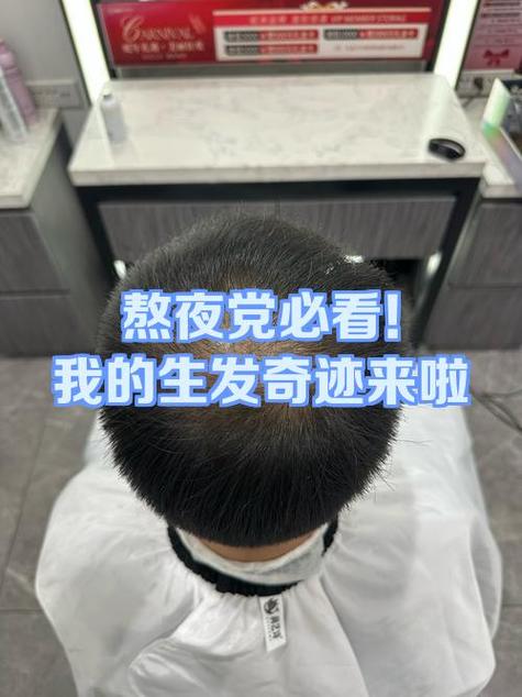 美图秀秀头发变多
