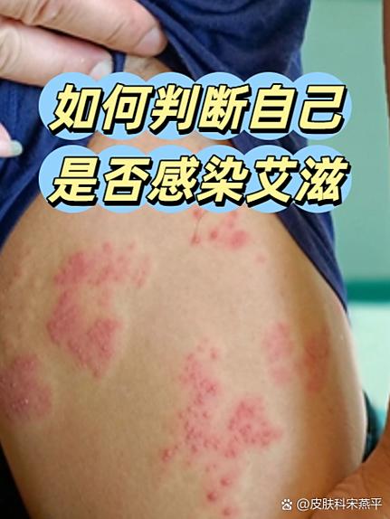 艾滋病毒的发现者图标