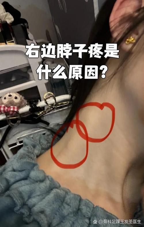 右边脖子酸痛什么原因缩略图