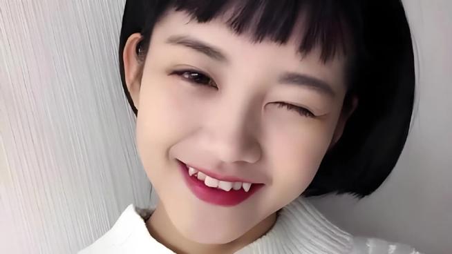 虎牙直播间发言不显示缩略图