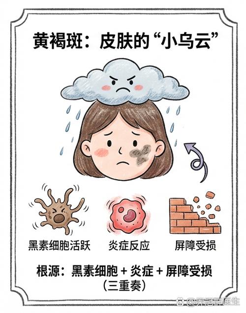 去除黑斑的最好方法缩略图