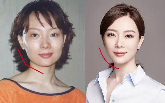 脸上长了圆圈是什么