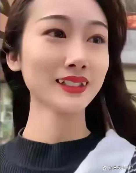 虎牙拔了好还是不拔好图标