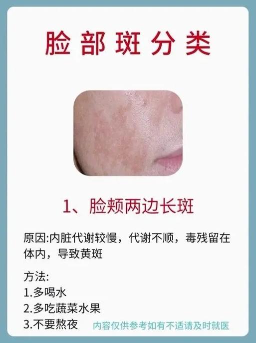 脸上斑块越来越大是什么原因游戏截图