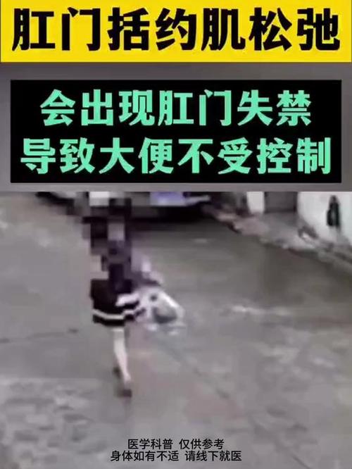 拳头进入肛门后肛门松弛怎么办游戏截图
