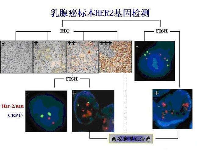 FISH检查费用大概多少钱缩略图