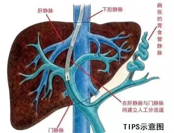 做肝介入手术痛苦吗游戏截图