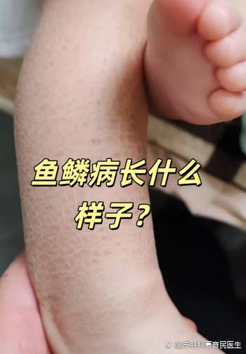 锦鲤鱼鳞翘起来