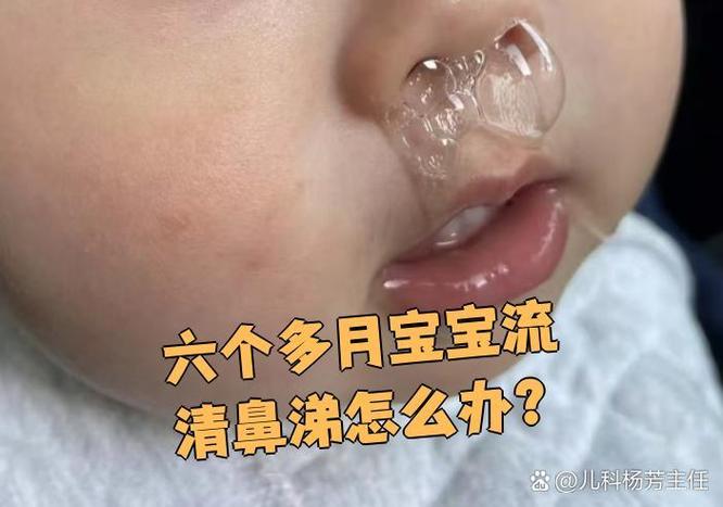 感冒鼻涕很黄很粘稠带血