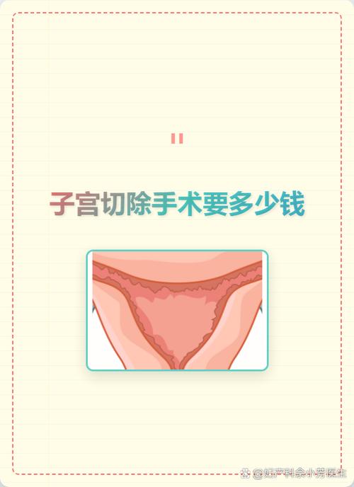 刮宫手术费一般多少钱缩略图