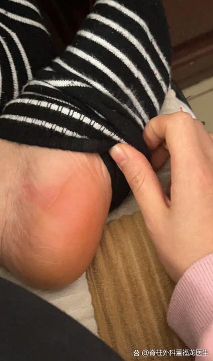 脚受凉会引起哪些症状图标