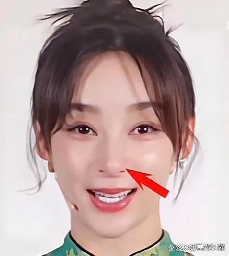 脸上紧绷绷的怎么回事缩略图