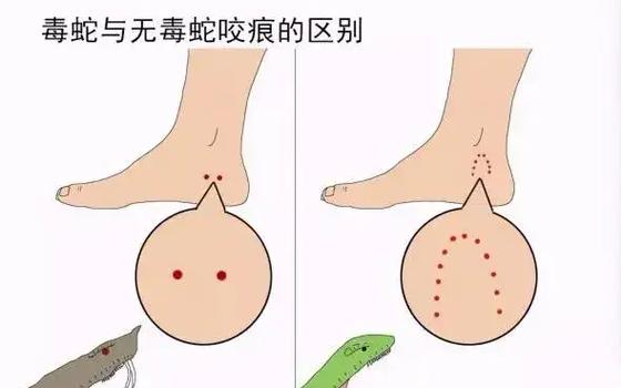 蟒蛇咬人疼吗游戏截图