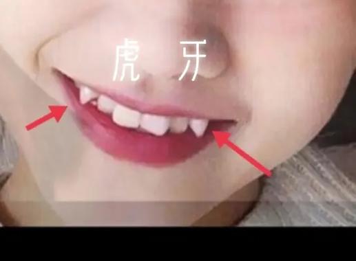 虎牙在玄学上代表什么图标