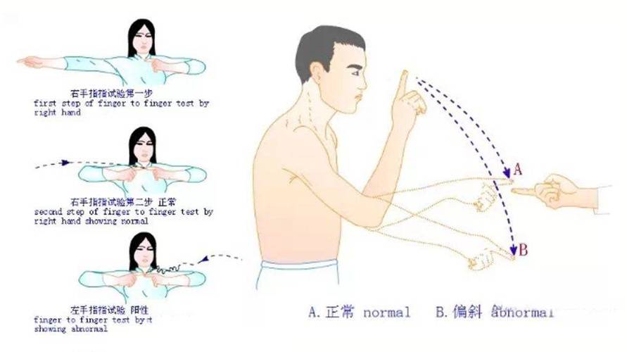 四肢不协调怎么办