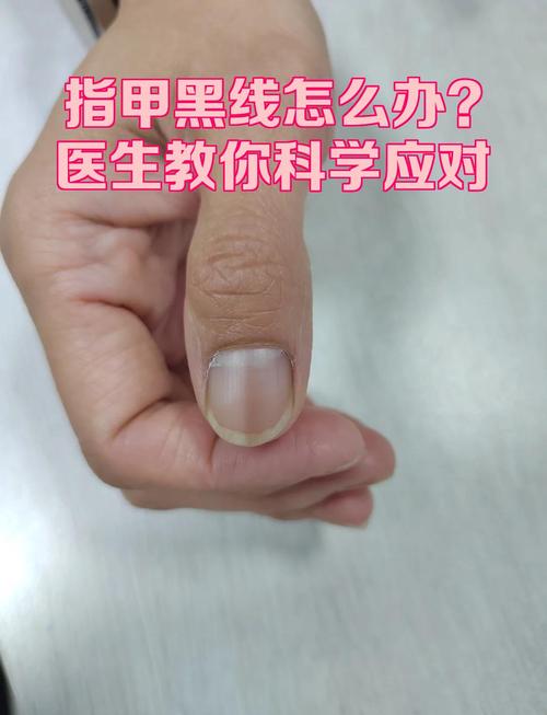 pdf导出word多一条黑线