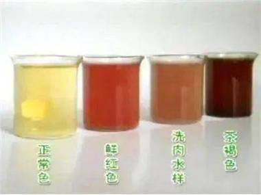 尿出红色的尿是什么原因