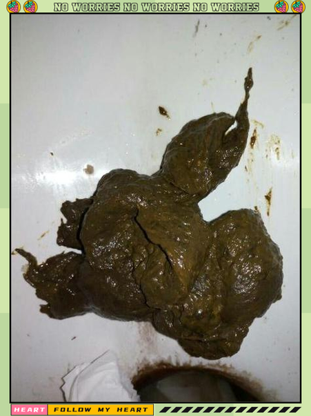 正常大便的照片