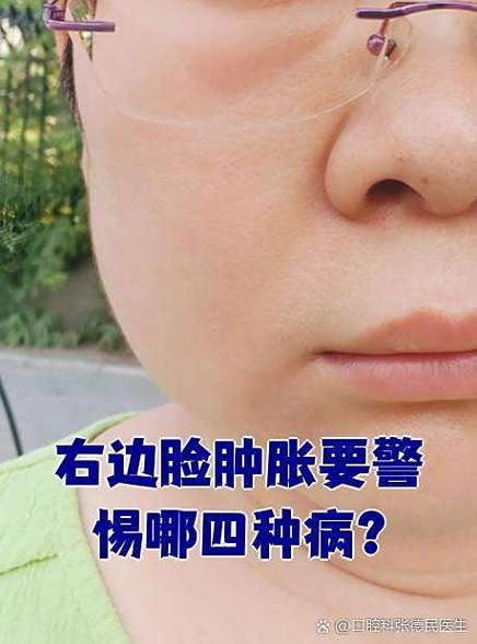 右边脸疼缩略图