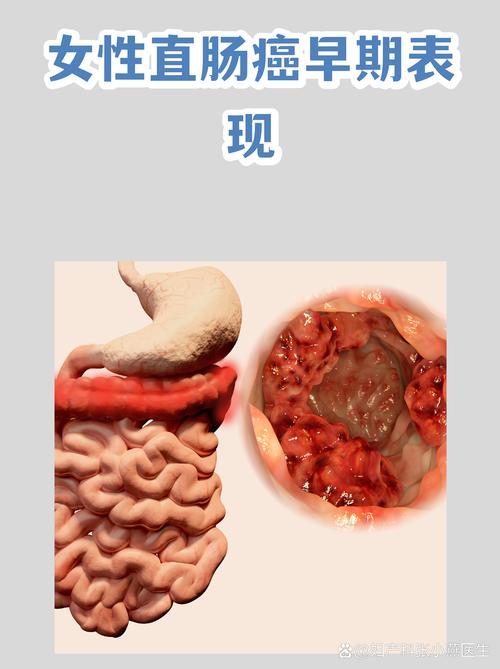女生拉稀拉肚子缩略图