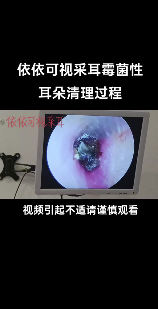 解决耳机异味方法缩略图