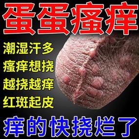 蛋皮痒最快止痒药膏