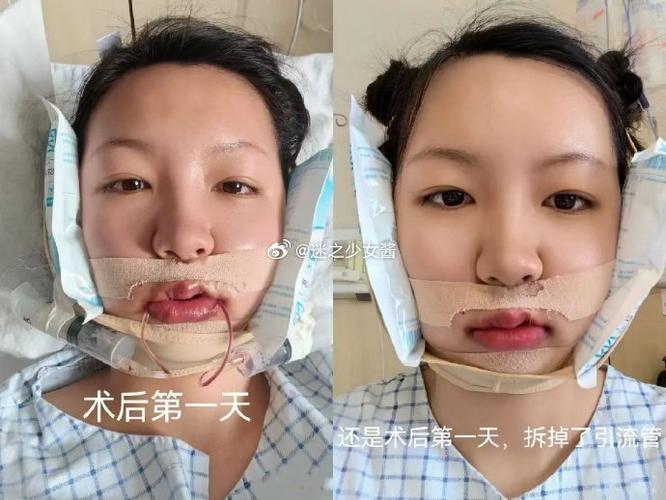 正颌手术费用一般是多少钱游戏截图