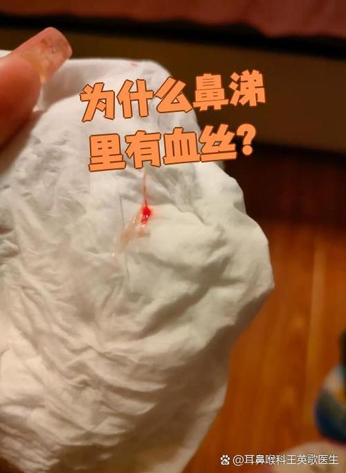 鼻子里出来一坨带血的鼻涕图标