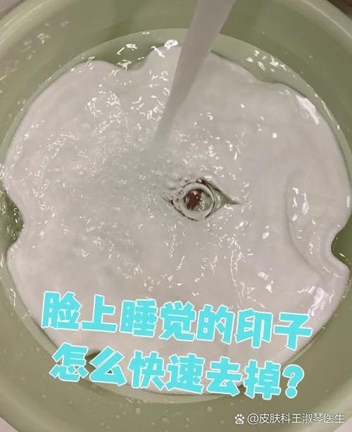 脸上睡出印子怎样快速消除