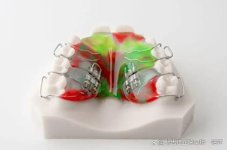 牙床歪斜导致脸嘴都歪缩略图