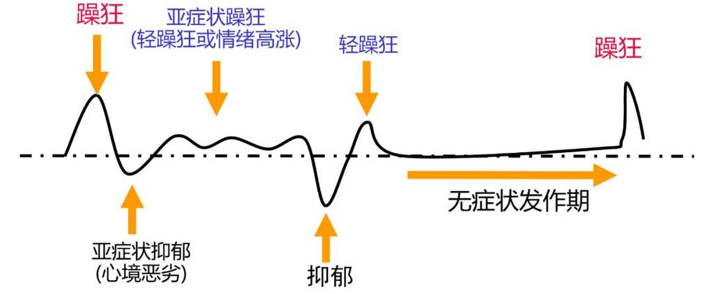 轻躁狂的智商缩略图