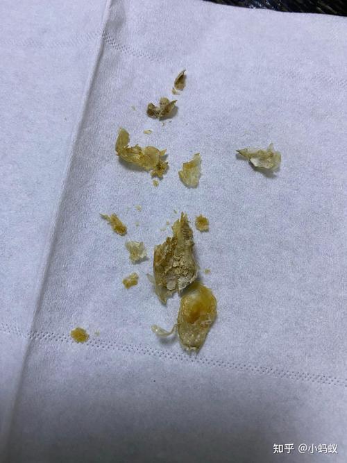 蓝牙耳机进耳屎了怎么清洗缩略图