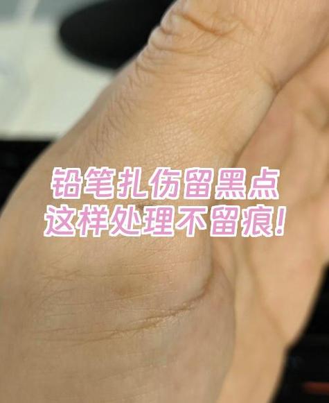 清除铅笔痕迹的妙招图标