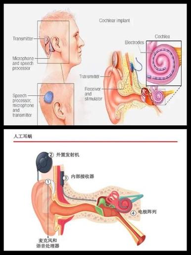 听耳机听力受损可以恢复吗