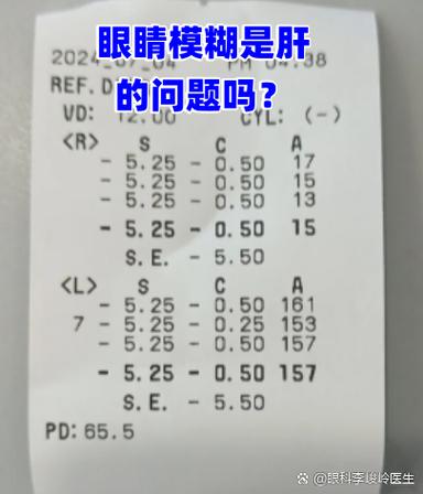 眼睛模糊看不清是肝的问题吗