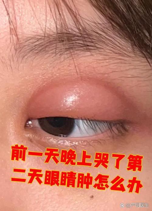 女生眼睛哭肿了怎么安慰她缩略图