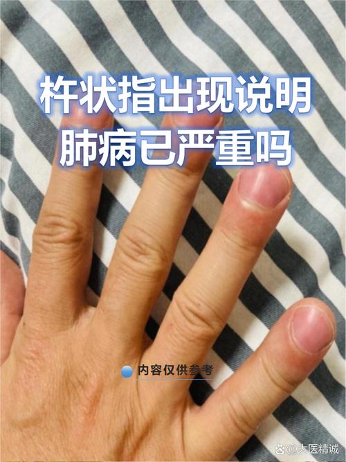 正常人张口几指